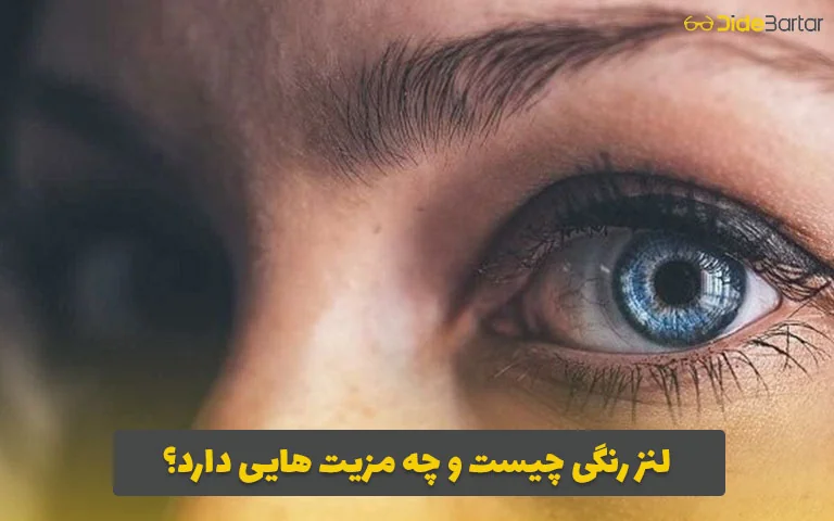 لنز رنگی چیست و چه مزیت هایی دارد؟