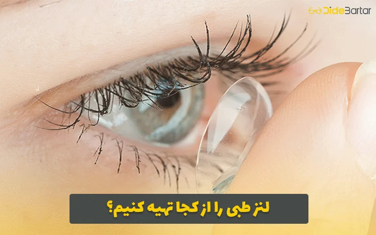 لنز طبی را از کجا تهیه کنیم؟