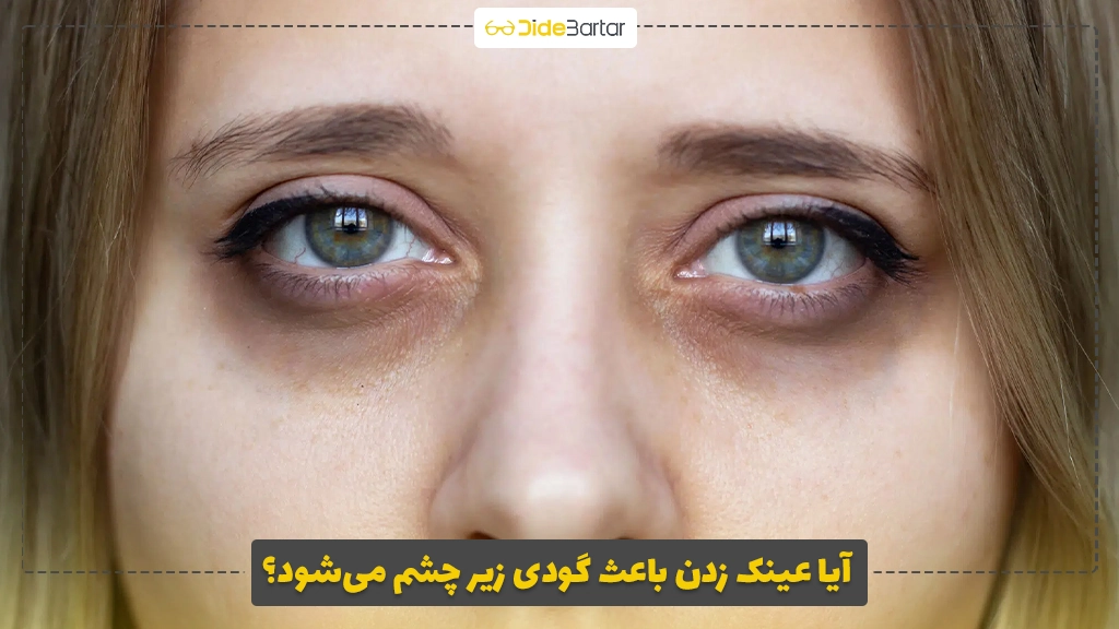 آیا عینک زدن باعث گودی زیر چشم می‌شود؟