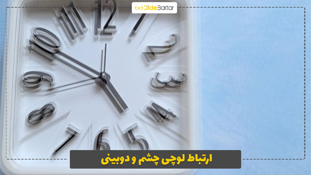 ارتباط لوچی چشم و دوبینی