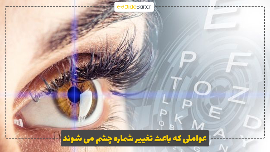 عواملی که باعث تغییر شماره چشم می شوند