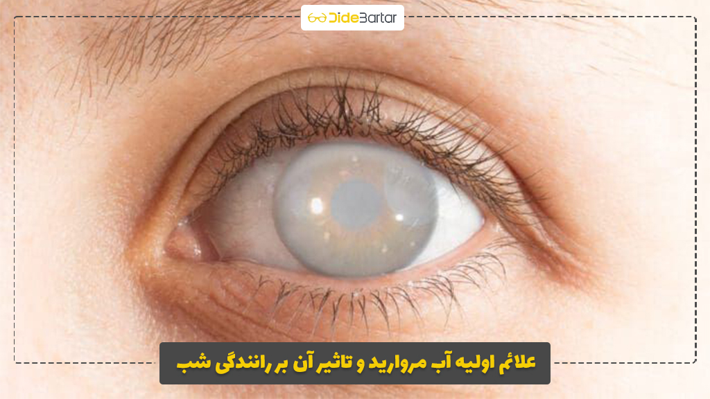 علائم اولیه آب مروارید و تاثیر آن بر رانندگی شب