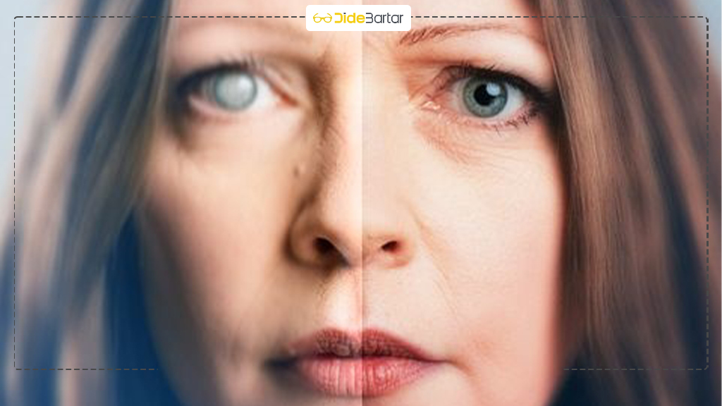 تفاوت بین گلوکوم زاویه باز و زاویه بسته