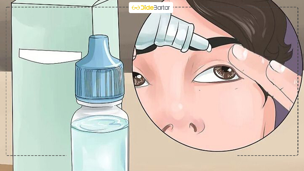 تفاوت میگرن چشمی و میگرن معمولی