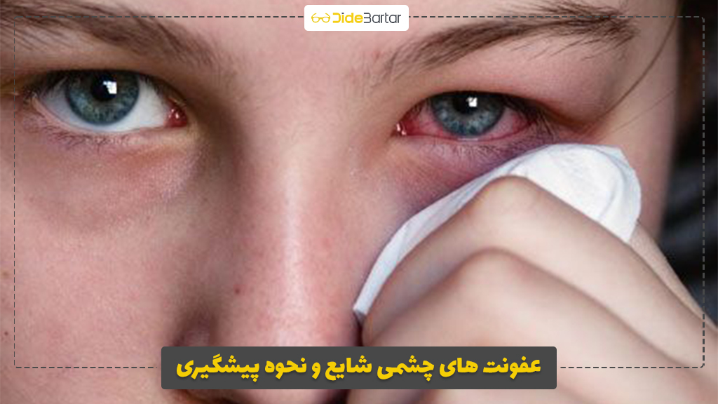 عفونت‌ های چشمی شایع و نحوه پیشگیری