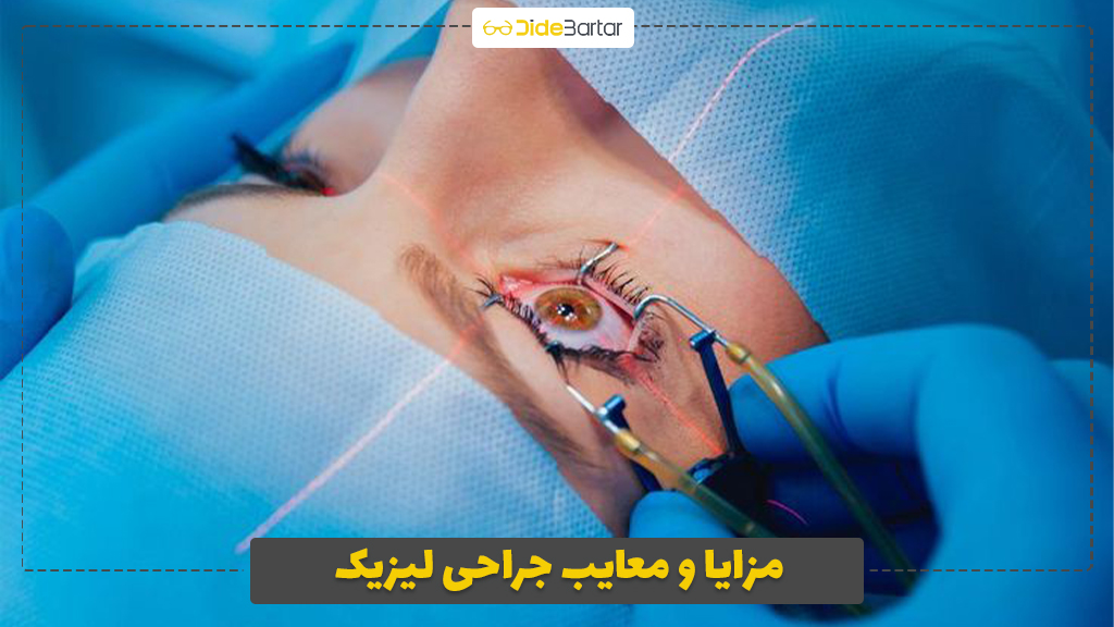 مزایا و معایب جراحی لیزیک