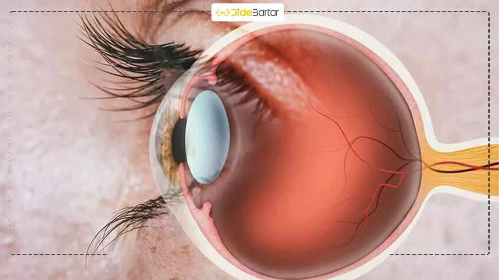 ویژگی های فیلتر آبی عدسی‌ ها