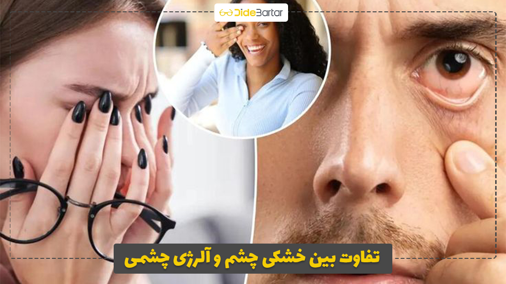 تفاوت بین خشکی چشم و آلرژی چشمی