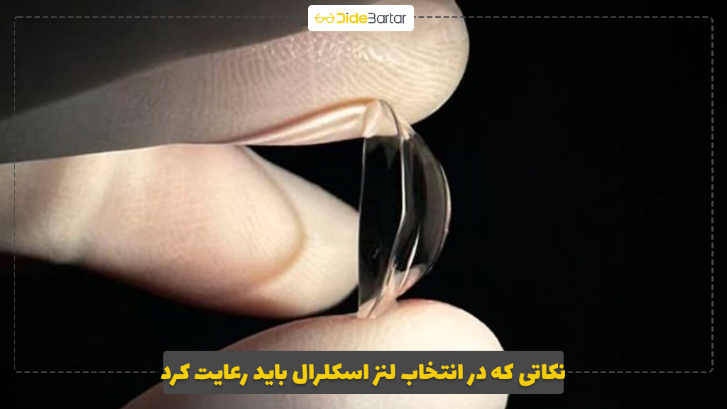نکاتی که در انتخاب لنز اسکلرال باید رعایت کرد