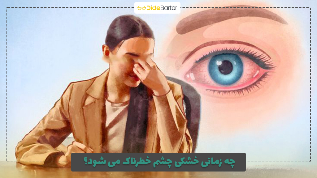 چه زمانی خشکی چشم خطرناک می‌ شود؟